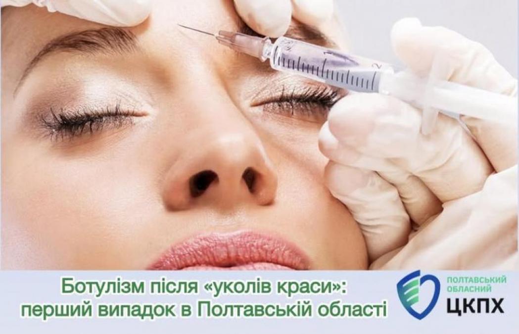 На Полтавщині зафіксували перший випадок ботулізму після косметологічної процеду