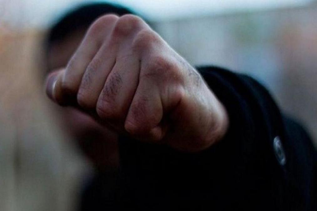 Бійка у кременчуцькому магазині: потерпілий з тяжкими травмами